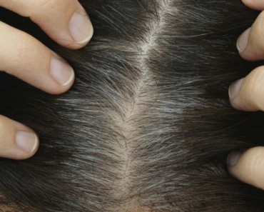 The Best Way to Manage Gray Hair
