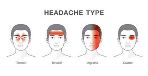 headaches