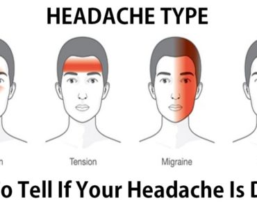 Dangerous Headache Types and How to Recognize Them