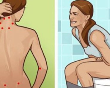 Fibromyalgia Symptoms That You May Not Know And How To Keep Them Under Control