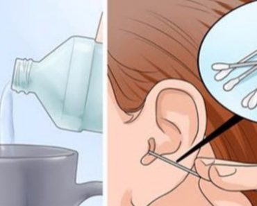 Ingredients to eliminate ear infections and earwax