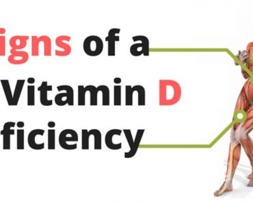 7 Signs You Have a Vitamin D Deficiency