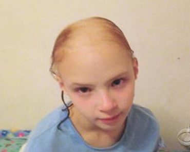 Official Alert Released: Little Girl Uses Popular Product And Loses Her Hair
