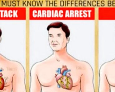 The Definitive Way To Know If You Are Having A Stroke, Heart Attack Or Cardiac Arrest