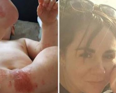Mother Goes On Facebook To Warn About The Dangers Of Kissing A Baby