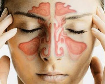 Clear Your Sinuses In Seconds Using Only Your Fingers