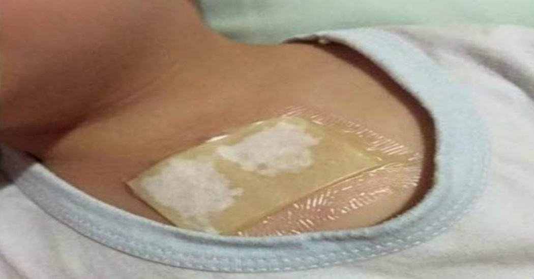 Treat A Bad Cough And Remove Mucus From The Lungs In One Night Using