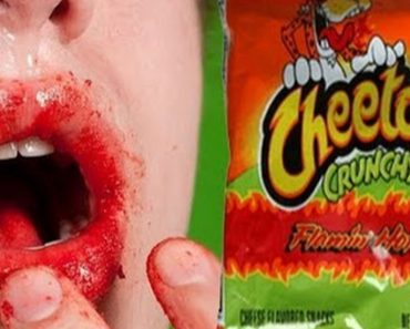 Doctors Are Now Warning Parents To Stop Giving Their Children Hot Cheetos