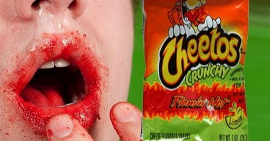 Doctors Are Now Warning Parents To Stop Giving Their Children Hot