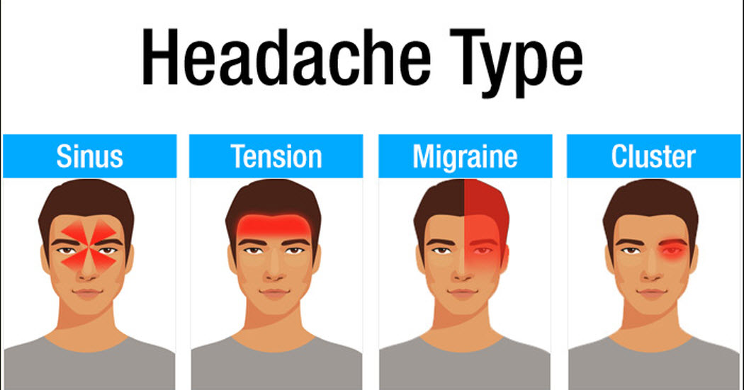 Headache Chart Types By Symptoms Location And Causes