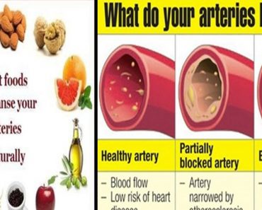 18 Foods That Clear The Arteries And Prevent Heart Attack