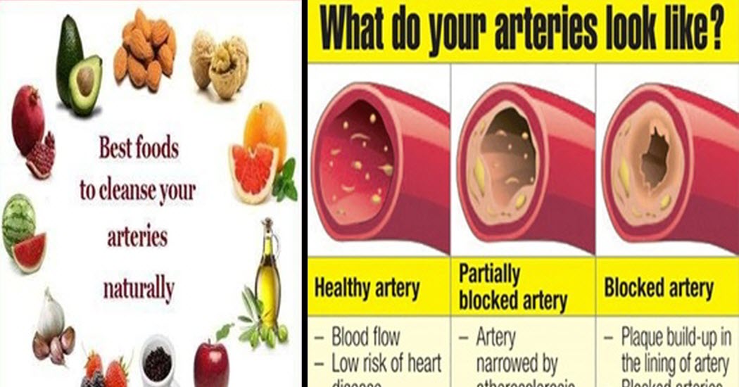 clean arteries naturally