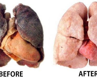 Do You Smoke? You Need To Do THIS For Clean Lungs