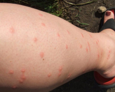 Do Mosquitoes Go After You First? You Need To Know This!