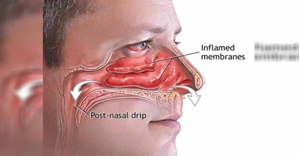 why-do-my-ears-ring-when-i-lay-down-tinnitus