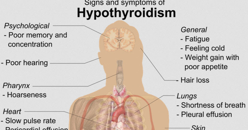 Hipotiroidismo depresion