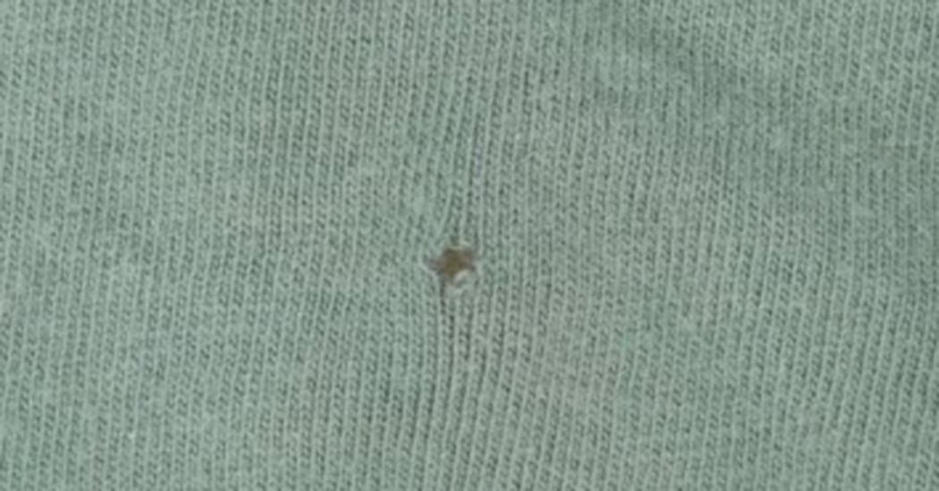 Think A Hole Has Ruined Your T-Shirt? Think Again! – Useful Tips For Home