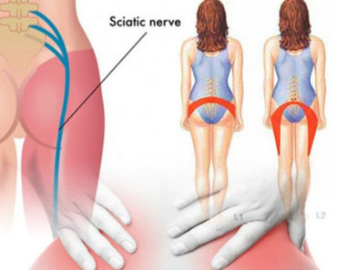 Easy Yoga Poses That Relieve Sciatica Pain Quickly